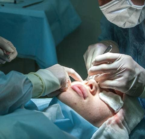 Chirurgia della Cataratta